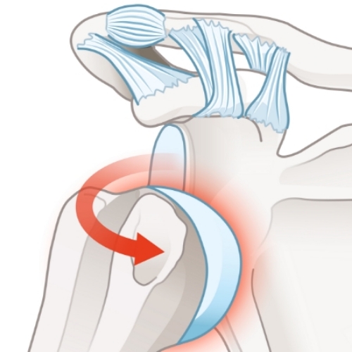 Dislocated-Unstable-Shoulder-Mana-Physical-Therapy-Lake-Como-East-Brunswick-NJ