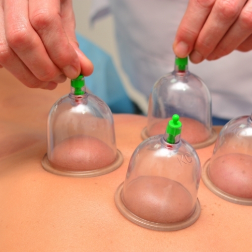 cupping-Mana-Physical-Therapy-Lake-Como-East-Brunswick-NJ